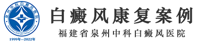 福建省泉州中科白癜风医院【官方网站】